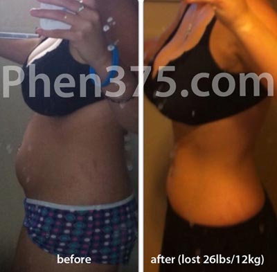 kara πριν και μετά phen375 Πού να βρείτε Phen375 Το Ultimate χάπι απώλειας βάρους στη χώρα σας Κριτικές Phen375 - The Best Fat Burner Από το 2016 που λειτουργεί